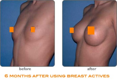 breast-actives-before-after